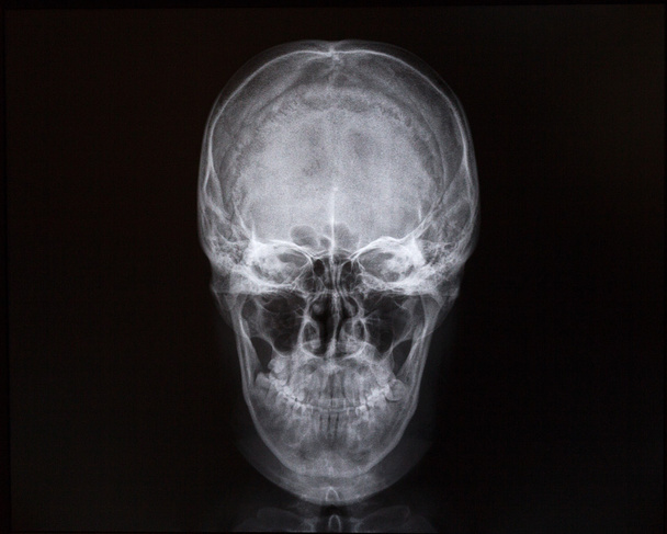 Рентгенівські промені черепа та внутрішньої порожнини. Медицина
 - Фото, зображення