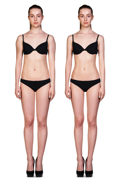 Femme avant et après perdre du poids
 - Photo, image