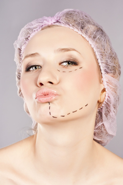 Inyección cosmética de botox en la cara femenina. - Foto, imagen