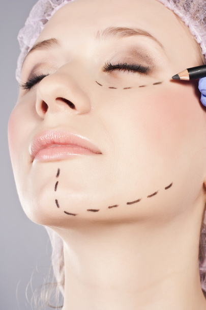 Cosmetic botox injection in the female face. - Φωτογραφία, εικόνα