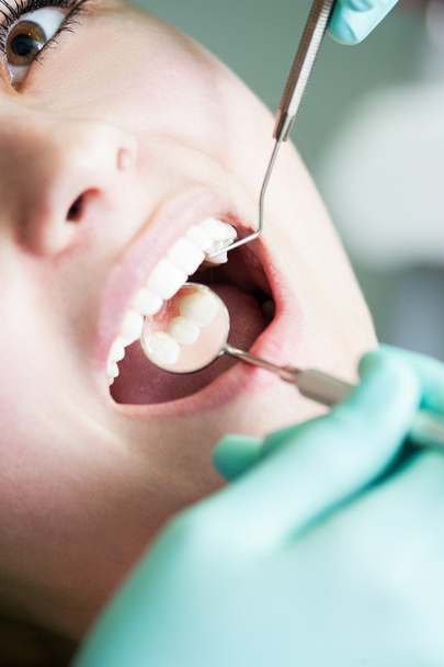 Οδοντιατρικές εξετάσεις με αντανάκλαση καθρέφτη - Φωτογραφία, εικόνα