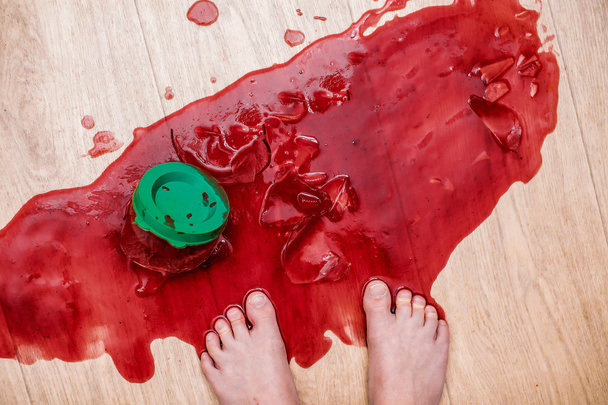 odłamki złamane słoików dżemu leżącego u stóp dziecka - Zdjęcie, obraz