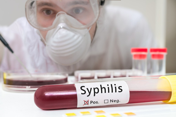 Tubo de ensayo con sangre para la prueba de sífilis delante del investigador
. - Foto, imagen