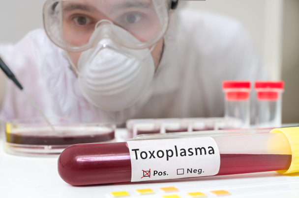 Il ricercatore sta analizzando la provetta con sangue per Toxoplasma
. - Foto, immagini