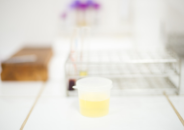 Échantillon d'urine pour examen urinaire en laboratoire
. - Photo, image