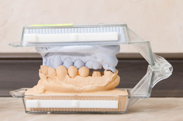 Dental casting gypsum models plaster - Photo, Image