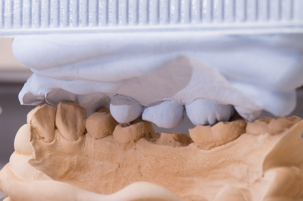 Moule dentaire pour prothèses dentaires
 - Photo, image