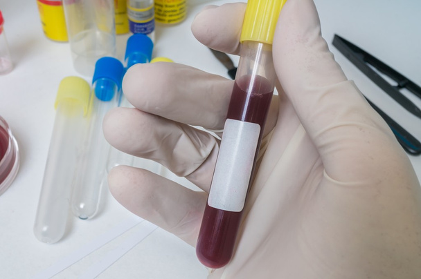 Рука дослідника тримає пробірку із зразком крові
 - Фото, зображення