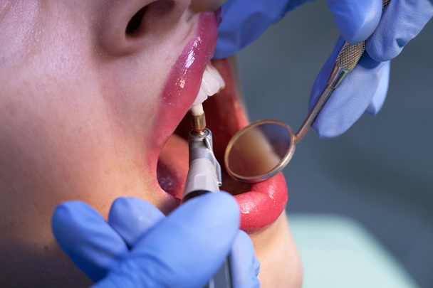 Professional dental instruments - Photo, Image