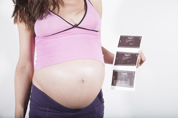 grávida mostrando ultra-som baby scan
 - Foto, Imagem