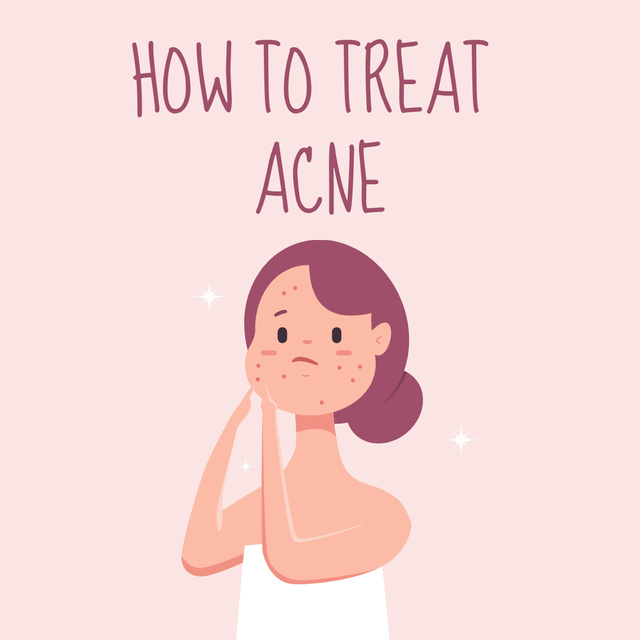 Acne treatment ad with Woman touching Face Instagramデザインテンプレート
