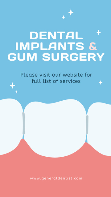 Ontwerpsjabloon van Instagram Story van Dental Implants and Gum Surgery Offer