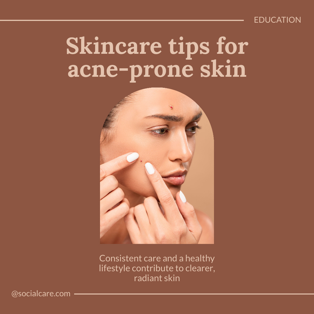 Skincare Educational Tips for Acne Skin in Brown Instagram – шаблон для дизайну