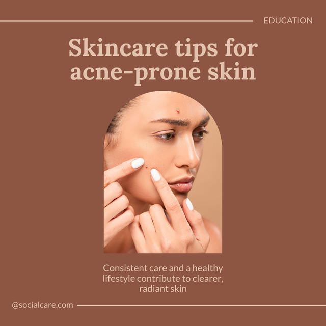 Skincare Educational Tips for Acne Skin in Brown Instagram Design Template
