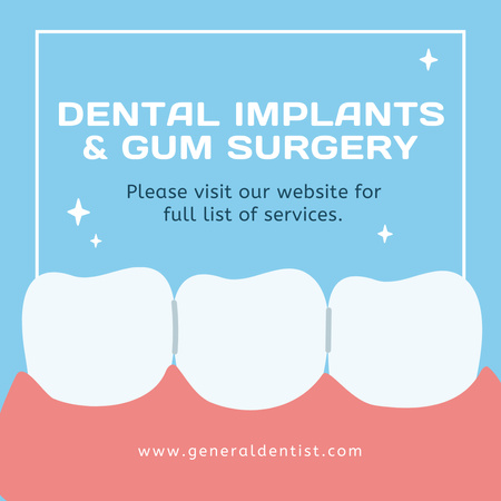 Dental Implants and Gum Surgery Offer Instagram Design Template