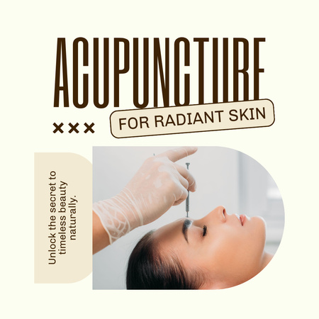 Acupuncture For Radiant Skin Option Προσφορά Instagram Πρότυπο σχεδίασης
