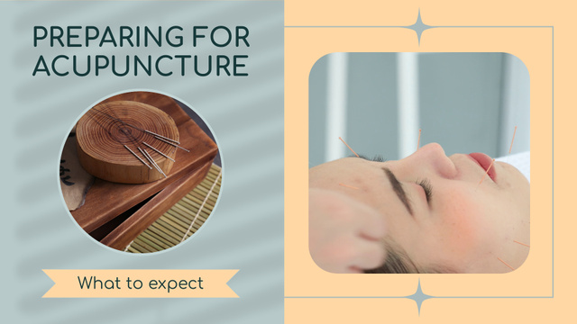 Preparing For Acupuncture Procedure Offer Full HD video Šablona návrhu