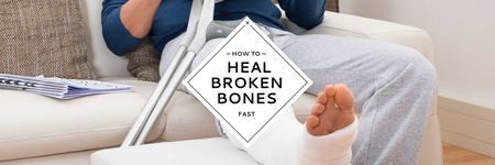 Guide for Fast Healing of Broken Legs Twitter Design Template