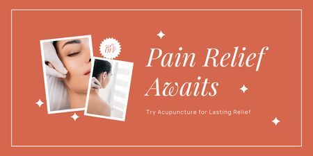 Best Acupuncture Procedure For Pain Relief Twitter Design Template