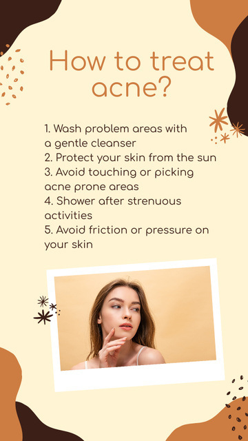 Essential Advice On Acne Treatment With Steps Instagram Storyデザインテンプレート