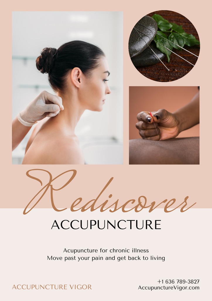 Acupuncture Procedure Offer Poster tervezősablon