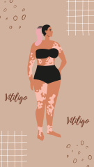 Illustration of Beautiful Girls with Vitiligo