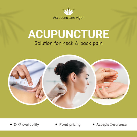 Designvorlage Maßgeschneiderte Akupunktur-Pflege für Rücken und Nacken für Instagram