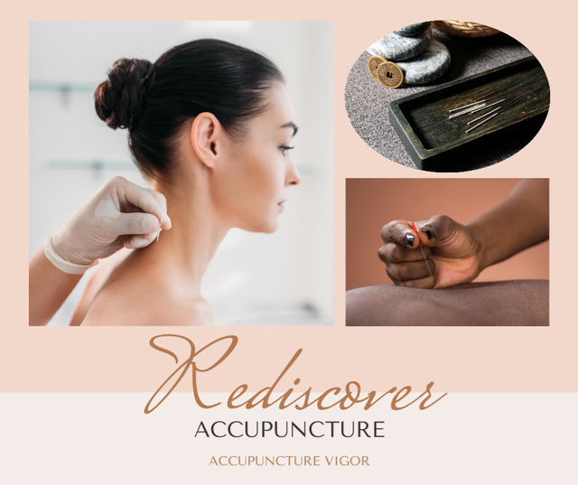 Plantilla de diseño de Relaxing Acupuncture Treatments For Back And Neck Promotion Facebook 