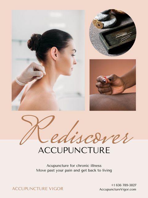 Providing Acupuncture Services In Beige Poster US Design Template