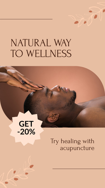 Natural Wellness With Acupuncture At Reduced Price Instagram Video Story Design Template