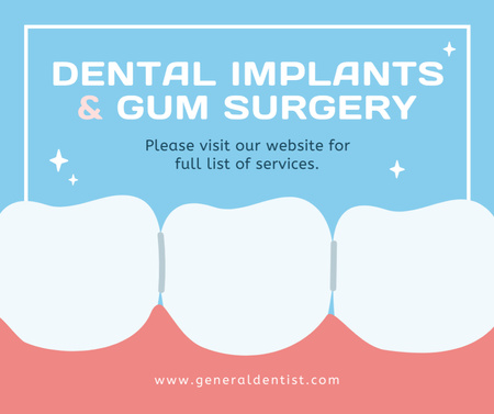 Dental Implants and Gum Surgery Offer Facebook Design Template
