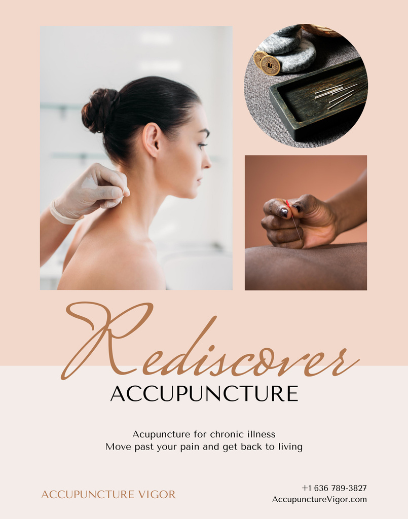 Designvorlage Calming Acupuncture Procedure Promotion In Beige für Poster 22x28in