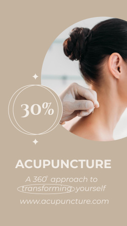 Designvorlage Acupuncture Procedure Discount Offer für Instagram Story