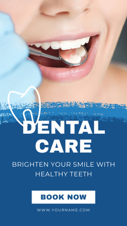 Plantilla de diseño de Oferta de Servicio de Blanqueamiento Dental Instagram Story 
