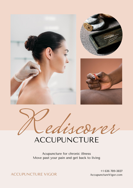 Plantilla de diseño de Acupuncture Procedure Offer Poster 