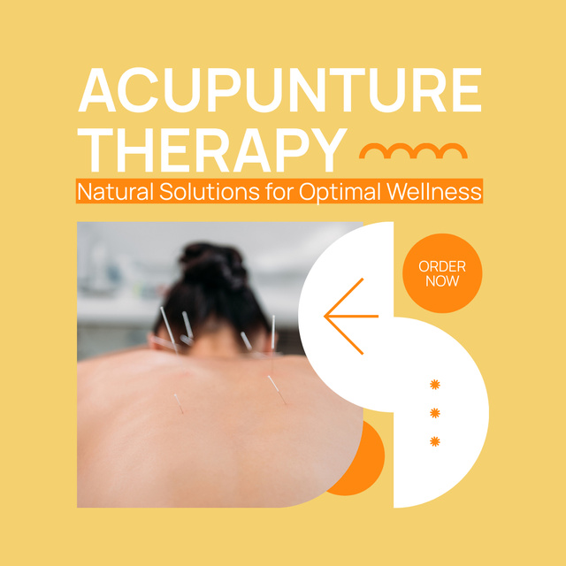 Effective And Optimal Acupuncture Session Offer Instagram AD Design Template