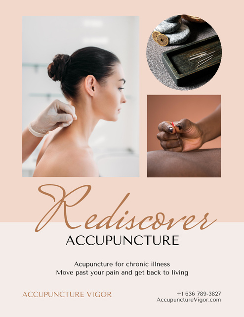 Mesmerizing Acupuncture Procedure Offer Poster 8.5x11in Tasarım Şablonu