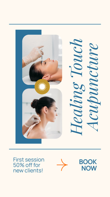 Plantilla de diseño de Discounted Healing Touch Of Acupuncture With Booking Instagram Video Story 