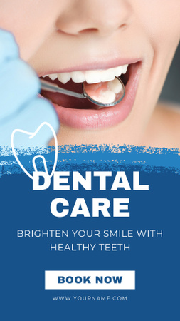 Offer of Dental Whitening Service Instagram Story Design Template