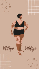 Illustration of Beautiful Girls with Vitiligo