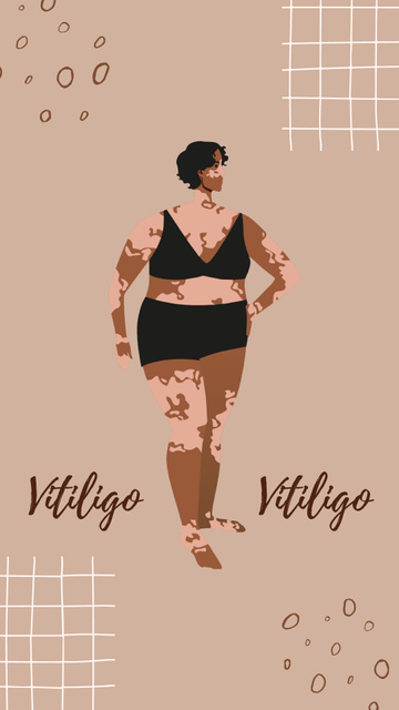 Designvorlage Illustration of Beautiful Girls with Vitiligo für Instagram Highlight Cover